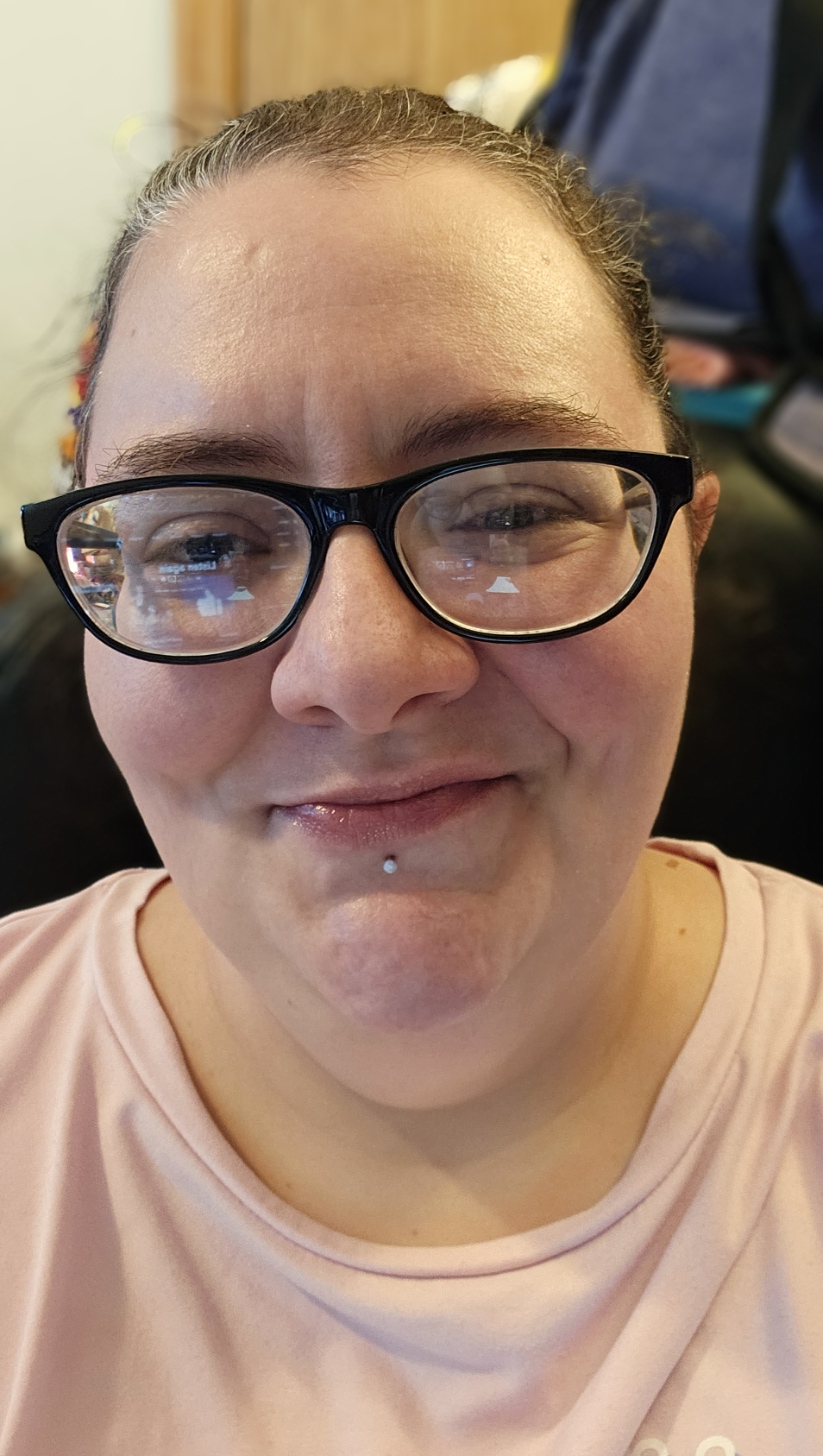 Weight loss check in photo to watch inch loss in the face