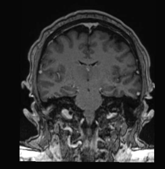 brain MRI image